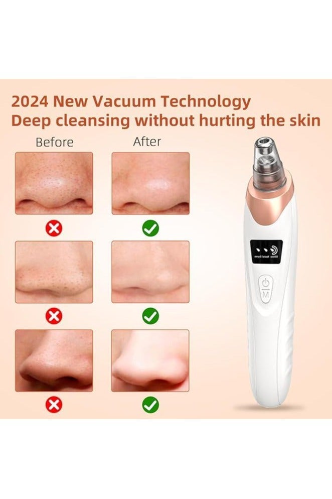2025 ADAK Electric Blackhead Remover Vacuum – 5 Adjustable Suction Levels + Probes, USB Rechargeable Facial Pore Cleaner, Acne Extractor & Skin Care Device for Adults (Extra 4 Pcs Tools) - Image 3