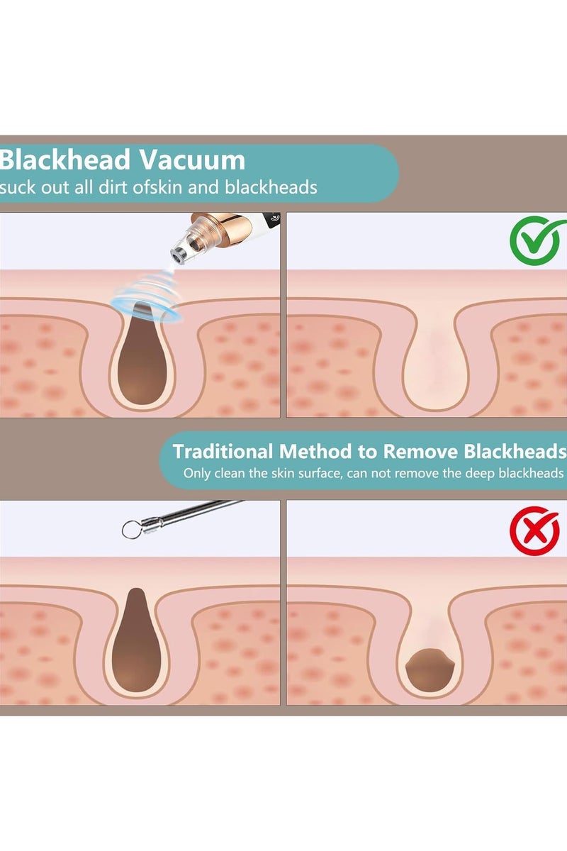 2025 ADAK Electric Blackhead Remover Vacuum – 5 Adjustable Suction Levels + Probes, USB Rechargeable Facial Pore Cleaner, Acne Extractor & Skin Care Device for Adults (Extra 4 Pcs Tools) - Image 4