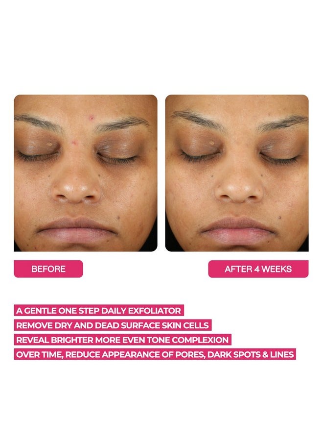 BeautyStat BeautyStat Triple Action One-Step Daily Exfoliating Peel Pad for Uneven Tone, Texture, Fine Lines, Enlarged Pores - Made in the USA - Gentle Exfoliator Pad with AHAs, BHAs, Glucosamine to Brighten  - Image 5