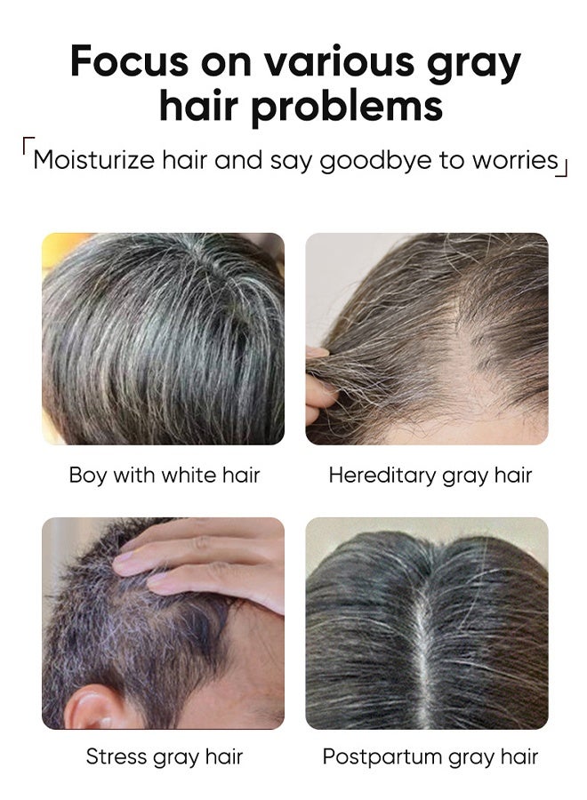 MOIKA Black Hair Serum, Polygonum Multiflorum Nourishing Serum, Natural Anti-Greying Hair Darkening Serum, for Thicker, Longer Hair, Restore Hair Natural Color 30ml - Image 3