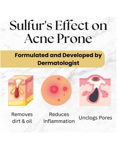 Skin Doctor Sulfur Soap - Gentle Cleansing for Acne-Prone Skin - Natural Solution for Clear, Healthy Complexion  - Image 5