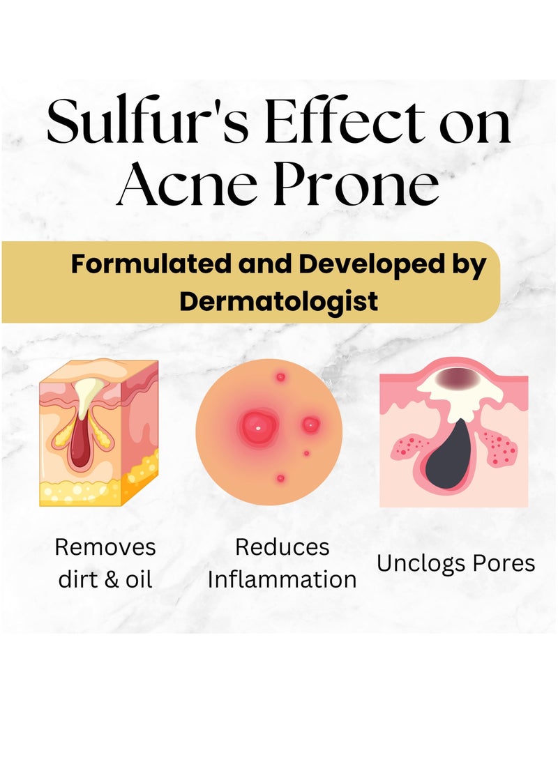 Skin Doctor - Sulfur Soap - Gentle Cleansing for Acne-Prone Skin - Natural Solution for Clear, Healthy Complexion - Image 1