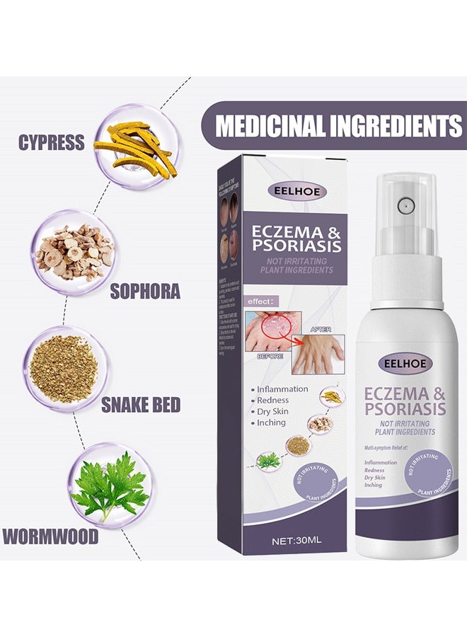 EELHOE Eczema And Psoriasis Atomizing Spray 30ML, Hand And Foot Moss Skin Repair, Relieve Itching, Skin Care And Jiejia Spray, Antibacterialnot Irritating Safety - Image 3
