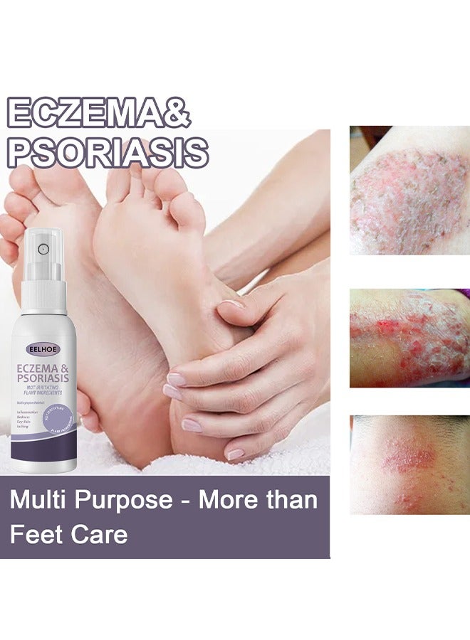 EELHOE Eczema And Psoriasis Atomizing Spray 30ML, Hand And Foot Moss Skin Repair, Relieve Itching, Skin Care And Jiejia Spray, Antibacterialnot Irritating Safety - Image 5