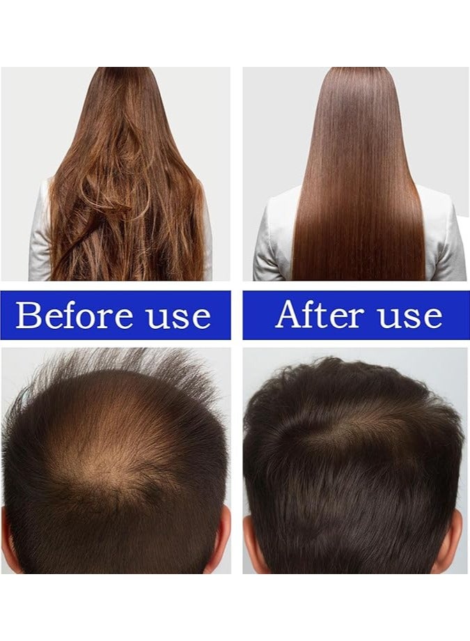 OUHOE Batana Oil, Veganic Natural Batana Oil Organic for Hair Growth, 100% Natural Batana Oil Organic For Healthy Hair For Men & Women, Enhances Hair & Skin Radiance - Image 3
