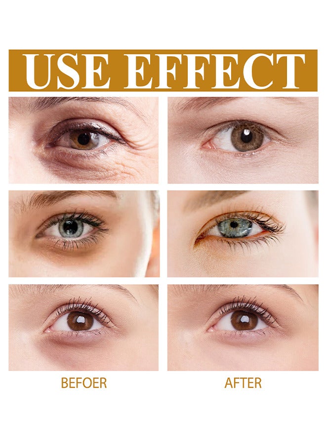 EELHOE Carnosine Eye Oil, Anti-Aging Serum For Dark Circles And Puffiness, Bags, Crows Feet, Wrinkles, With Hyaluronic Acid And Skin-Firming Peptides Eye Serum 10ML - Image 5