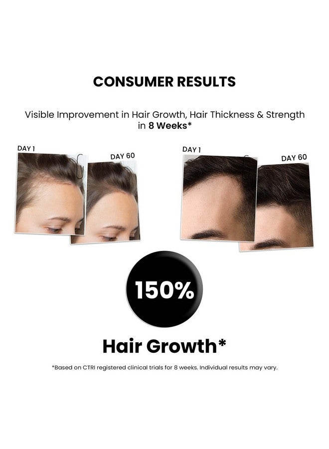 THRIVECO Hair Growth Serum 2.0 For Hair Growth & Hair Fall Control | With Redensyl + Anagain + Rosemary + Procapil + Capilia Longa | For Men & Women | 50Ml (Pack Of 6) - Image 2