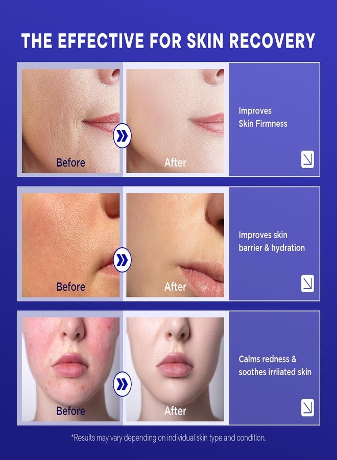 Lanmeri Copper Peptide Serum for Face:1% Copper Peptide (GHK-Cu) Anti-Aging Serum to Smooth Fine Lines, Improve Elasticity - Soothe & Repair Skin Barrier with Centella Asiatica - 30ml - Image 4