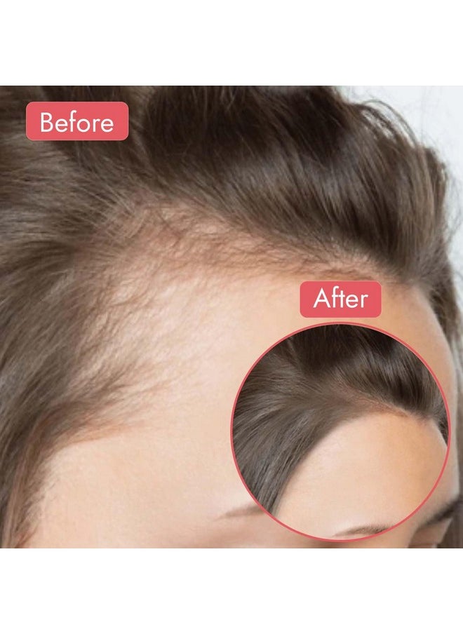 Aravi Organic - Batana Hair Oil For Hair Growth With Pumpkin Oil - Derived From American Oil Palm Nut - 200 Ml - Image 1