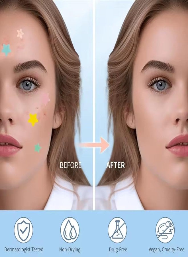 Rinpoche Acne Pimple Patch Facial Kit Hydrocolloid Pimple Patches For Face- Acne Treatment Clear Skin Pimple Patch 120 Star (3 Sheet) - Image 3