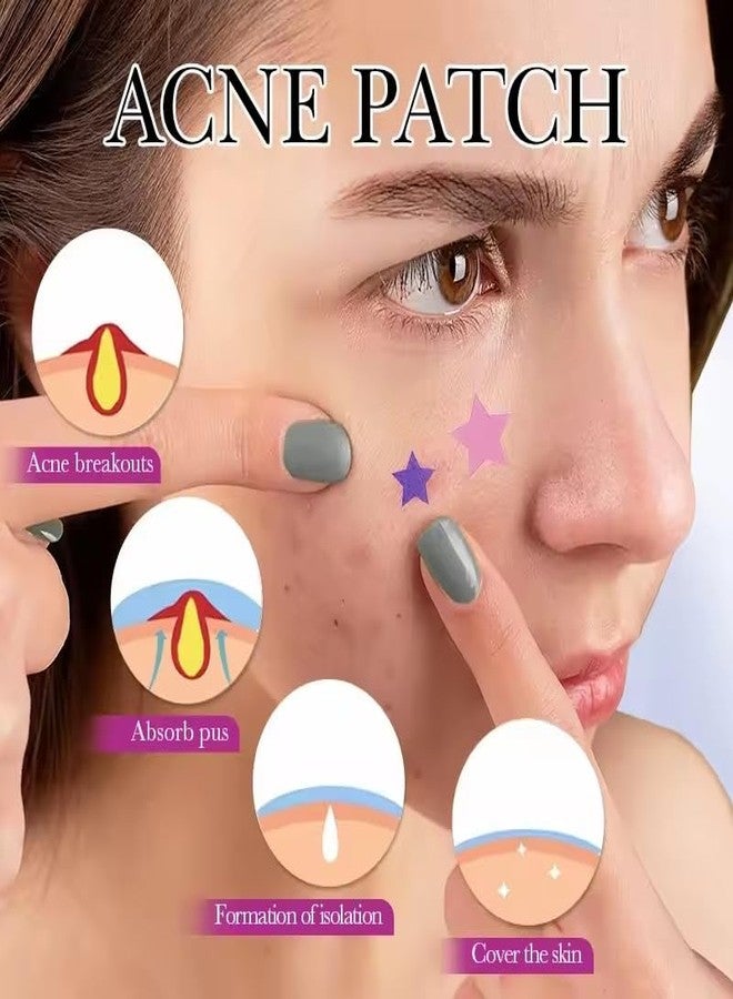 Rinpoche Acne Pimple Patch Facial Kit Hydrocolloid Pimple Patches For Face- Acne Treatment Clear Skin Pimple Patch 120 Star (3 Sheet) - Image 4