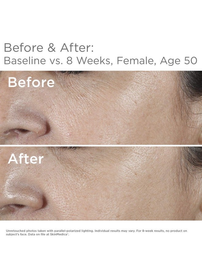 Skinmedica SkinMedica HA5 Rejuvenating Hydrator. Hyaluronic Acid Serum for Face with Five Types of Hyaluronic Acid that Smooth Fine Lines and Wrinkles, For All Skin Types, 1 Oz  - Image 5