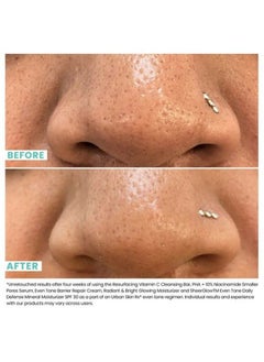 Urban Skin Rx Smaller Pores Serum | Includes Phas And 10% Niacinamide | Exfoliates Decongests And Tightens Pores For Clear Brighter & Smoother Skin | 1 Fl Ounce  - Image 5