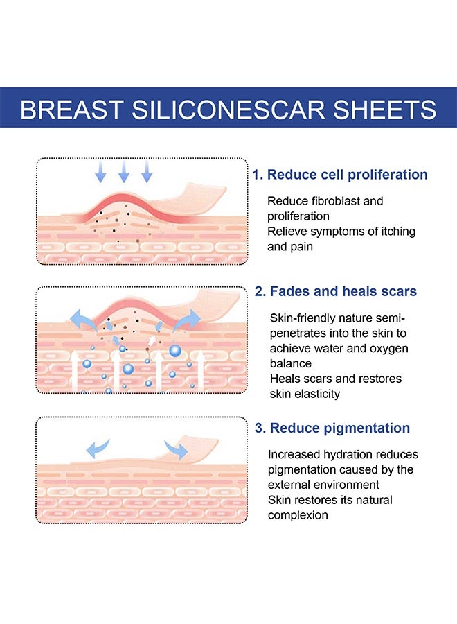 EELHOE Silicone Scar Sheets, Reusable Washable Silicone Scar Tape, Surgery Scars Removal Treatment, Medical Grade Silicone Scar Sheets for Breast 4Pairs - Image 2