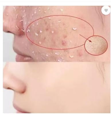 Generic Natural Face Body Scrub Cleansing Exfoliating Gel Moisturizing Pack Of 1 Scrub  - Image 5