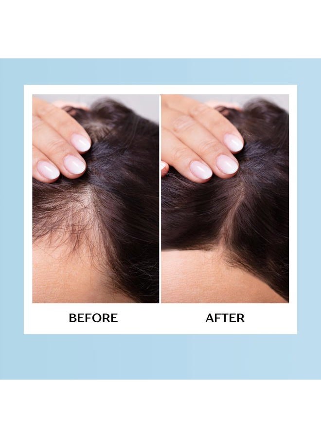 Mediceuticals Therapro Hair Gain Supplement for men & women - 60 Tablets - Image 5