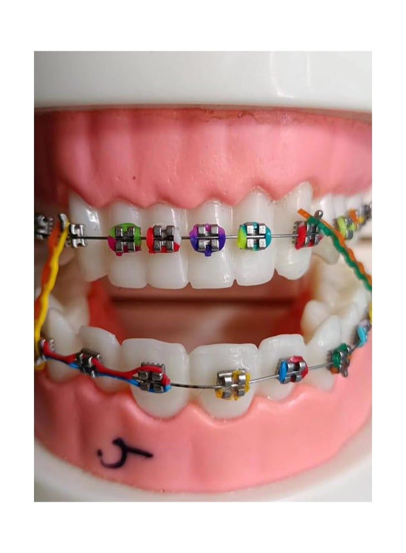 هالونهي 20 عصا (320 قطعة) ربطات تقويم الأسنان ثنائية اللون، ربطات تقويم الأسنان متعددة الألوان، أربطة مطاطية مرنة على شكل حلقة دائرية، أكثر متعة للأطفال والمرضى (أزرق وأصفر) - Image 5