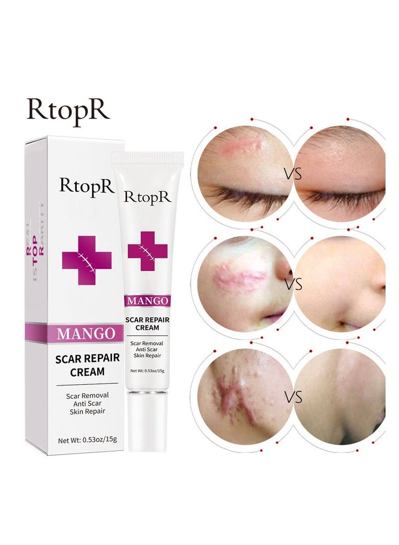 RtopR Scar Repair Cream Stretch Mark Removal Gel - Image 5
