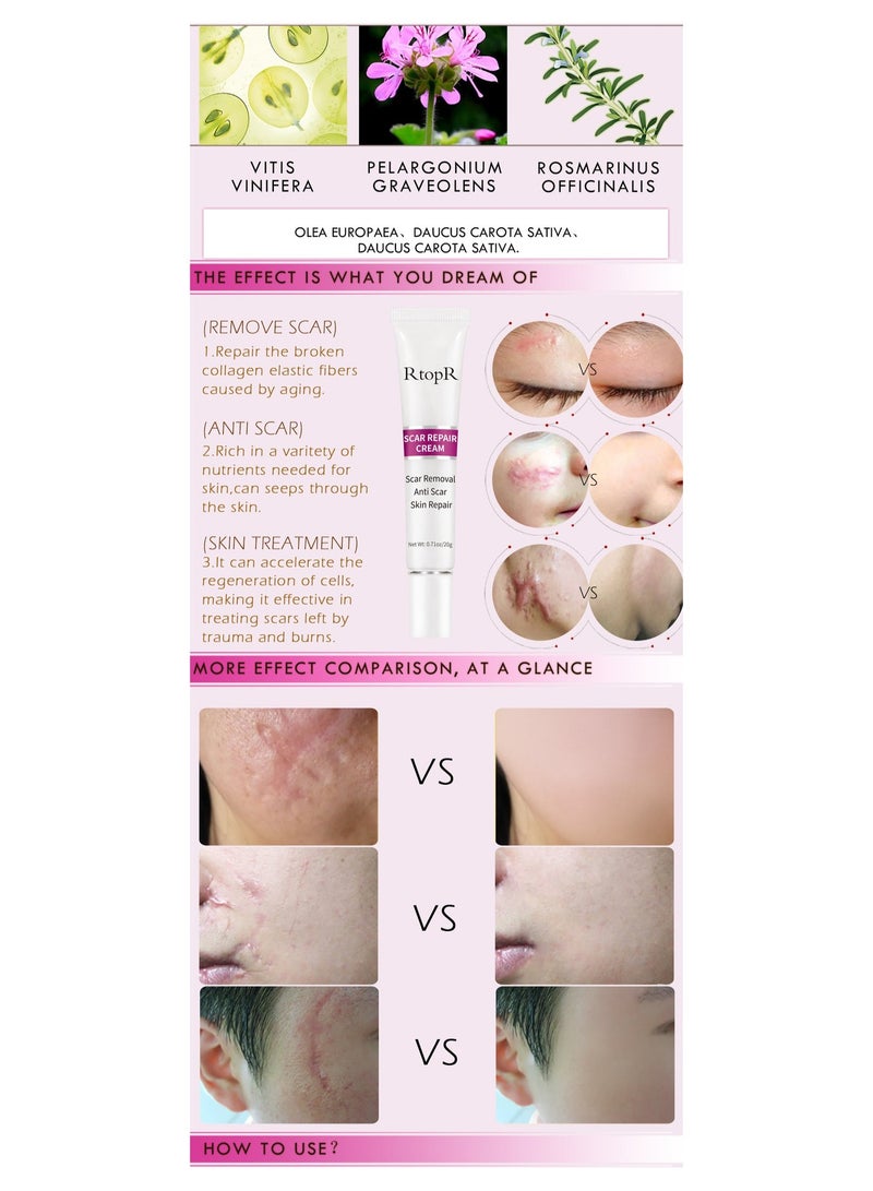 RtopR Scar Repair Cream Stretch Mark Removal Gel - Image 2