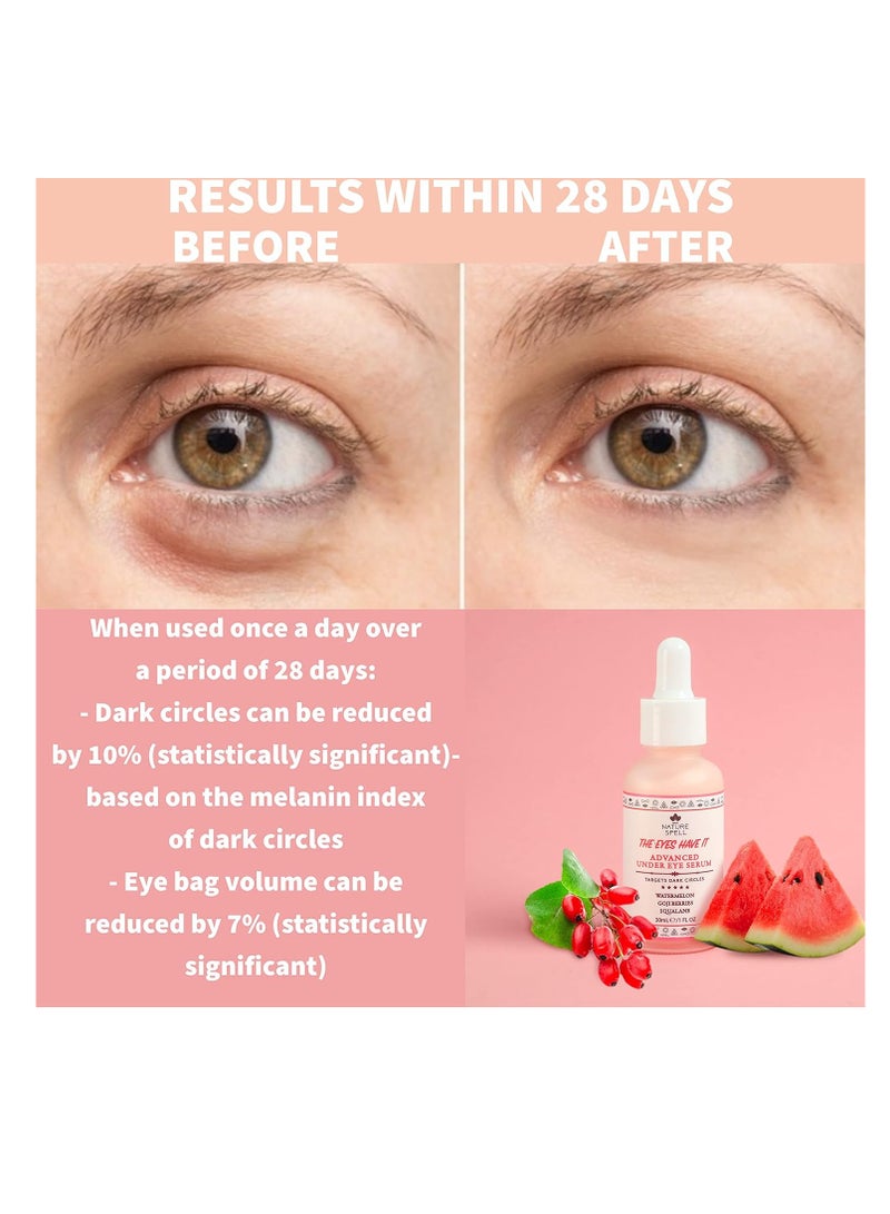 Nature Spell Nature Spell The Eyes Have It Advanced Under Eye Serum – 30ml | Reduces Dark Circles & Puffiness - Image 3