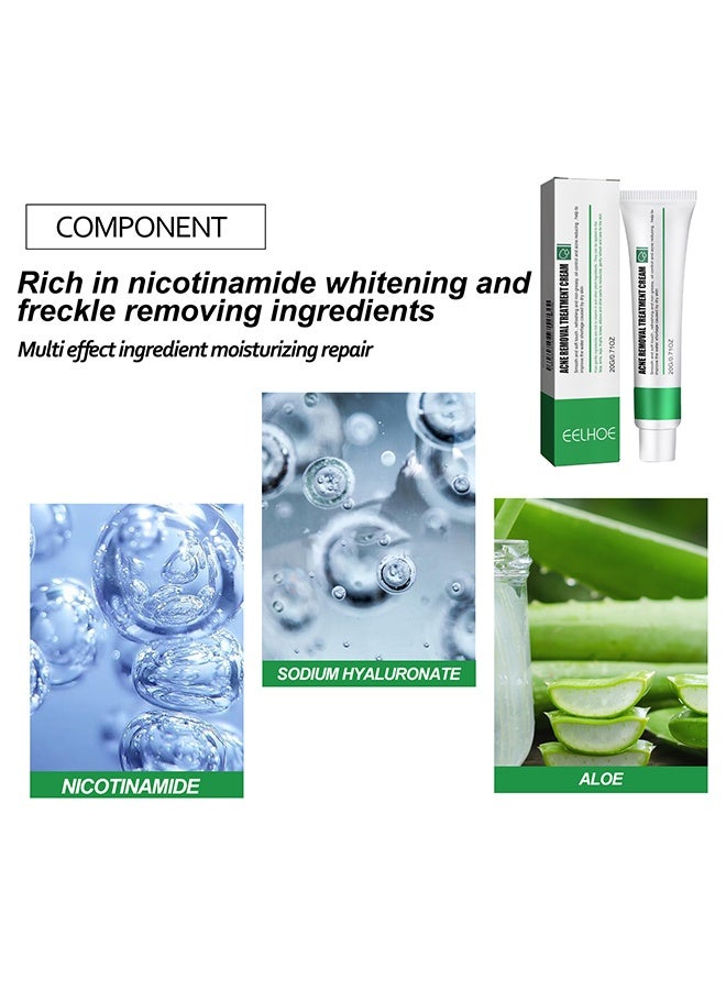 EELHOE Acne Removal Treatment Cream, Oil Control Acne Removal Acne Pimple Repair Cream, Acne Spot Treatment for Face & Acne Dots, Natural Cystic Acne Treatment Suitable for Oily And Acne Prone Skin 20g - Image 4