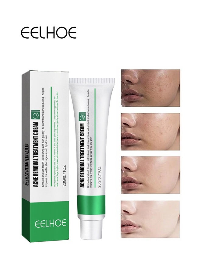 EELHOE Acne Removal Treatment Cream, Oil Control Acne Removal Acne Pimple Repair Cream, Acne Spot Treatment for Face & Acne Dots, Natural Cystic Acne Treatment Suitable for Oily And Acne Prone Skin 20g - Image 2