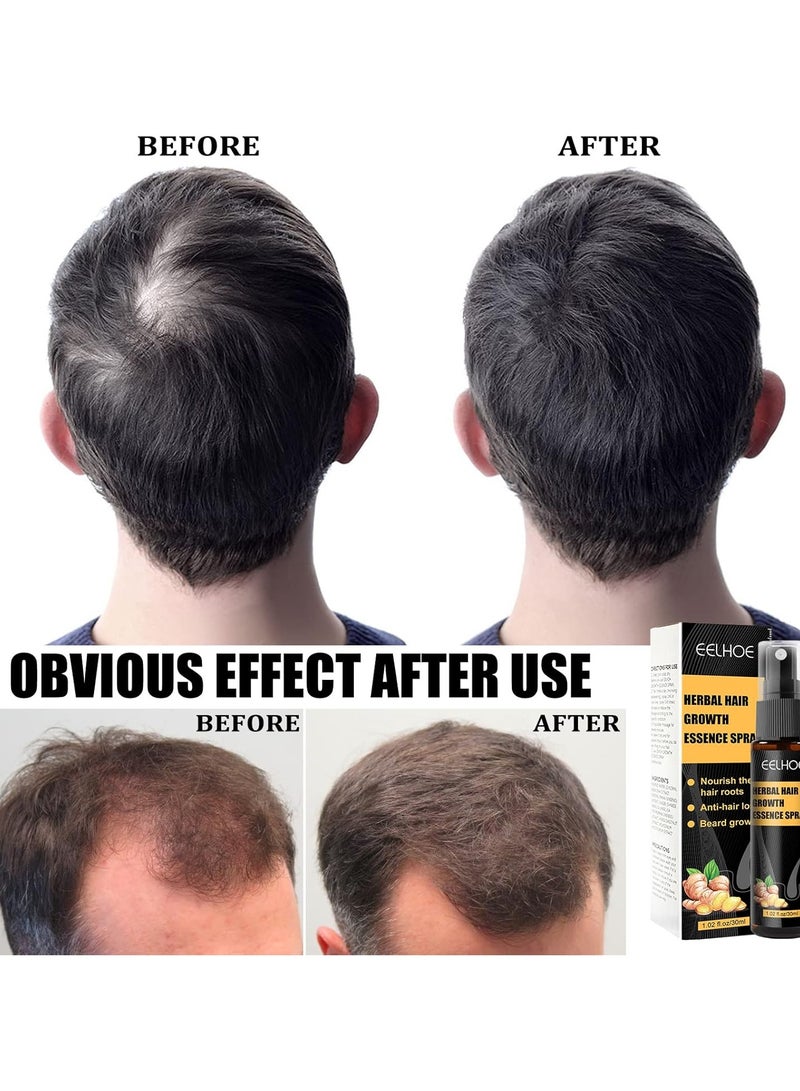 EELHOE 30ml Herbal Hair boost Essence Spray Roller Set Hair Root Nourishing Anti Loss Beard Growth Promoting Ginger Hair Spray - Image 3