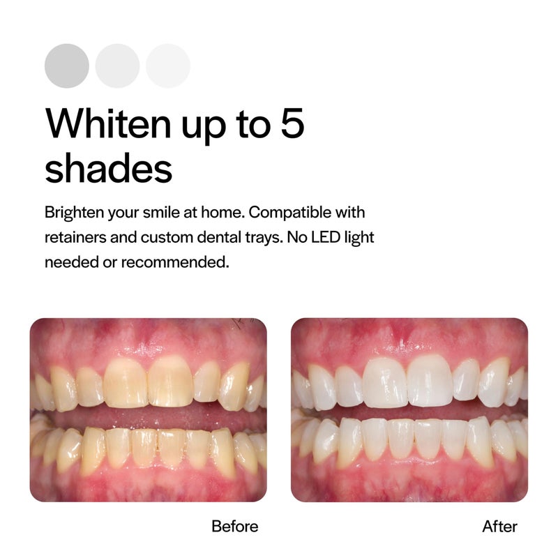 Opalescence 10% Teeth Whitening Kit - Gel Syringes Refills - Low Sensivity (4 Syringes) - Fluoride, Carbamide Peroxide - Made in The USA by Ultradent 5211-2 - Image 3