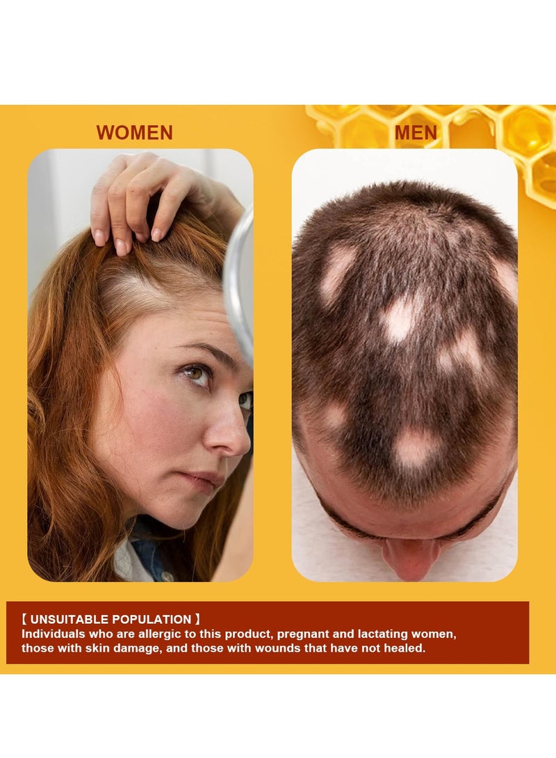 سوميفون كريم نمو الشعر بسم النحل لعلاج الثعلبة، علاج فعال للثعلبة وتساقط الشعر - Image 4