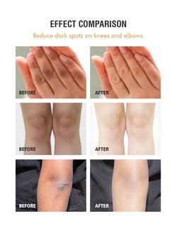 MOOYAM Dark Knees and Elbows Strong Whitening Cream, Whitening Cream for Correcting Dark Spots, Armpits, Neck, Knee, Elbow, Inner Thigh, Intimate Area, 120g  - Image 2