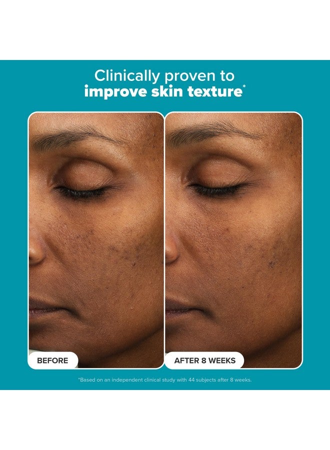 باولاز تشويس مقشر باولا تشويس بحمض الماندليك بنسبة 6% + حمض اللاكتيك بنسبة 2%، تقشير يومي لطيف بحمض ألفا هيدروكسي لعلاج تغير اللون والملمس الخشن والإشراق، للبشرة الحساسة، خالٍ من العطور والبارابين، 1 أونصة سائلة. - Image 3