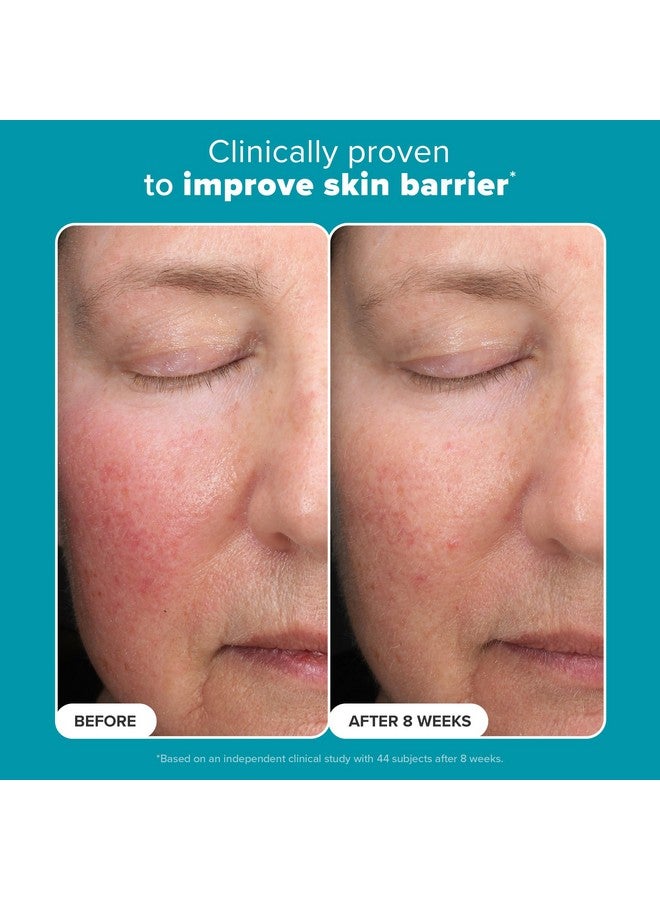 باولاز تشويس مقشر باولا تشويس بحمض الماندليك بنسبة 6% + حمض اللاكتيك بنسبة 2%، تقشير يومي لطيف بحمض ألفا هيدروكسي لعلاج تغير اللون والملمس الخشن والإشراق، للبشرة الحساسة، خالٍ من العطور والبارابين، 1 أونصة سائلة. - Image 4