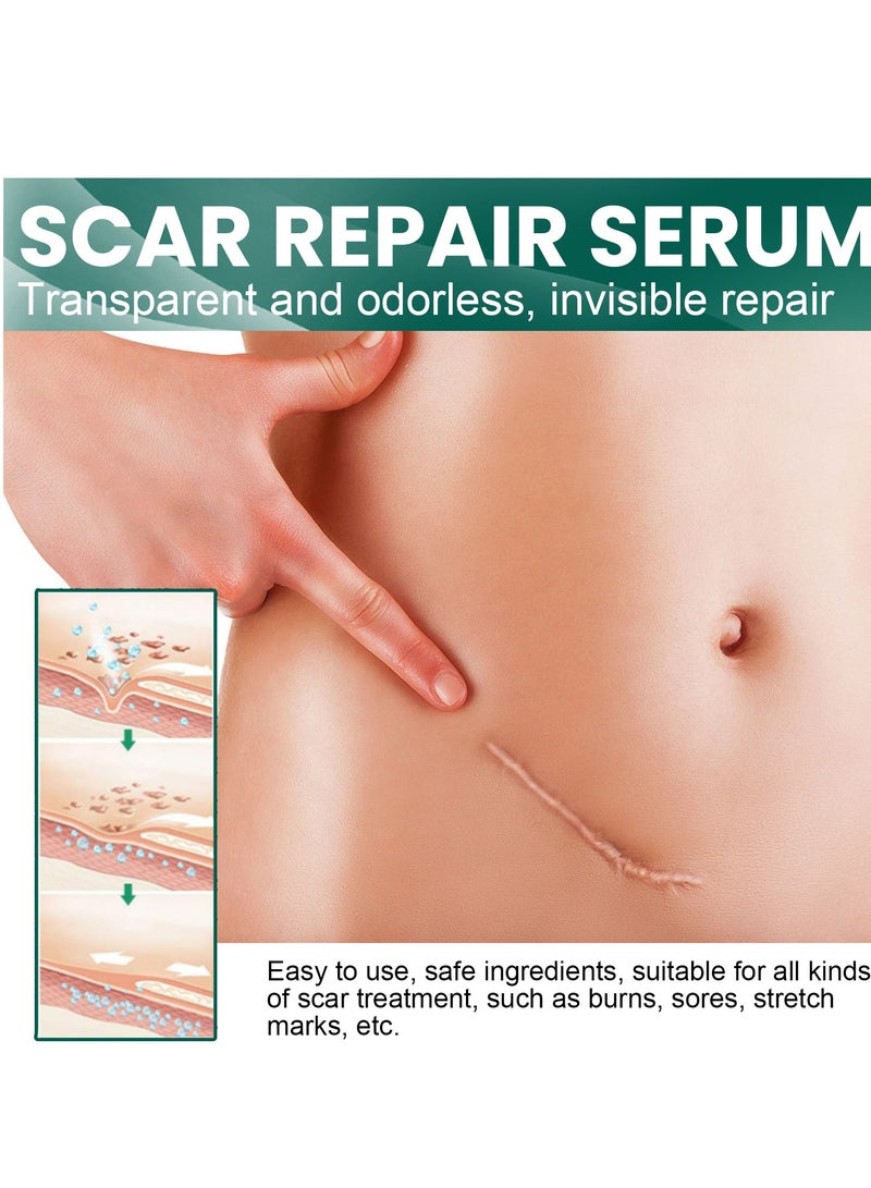 إيلهو مصل إصلاح الندبات Helip suabero nlscarryoet Scal - Image 3