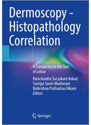 Dermoscopy - Histopathology Correlation: A Conspectus in the Skin of colour - pzsku/Z92EDEF81C3AE242936F3Z/45/_/1744118611/de38ffd5-1beb-4cbe-a6c1-3f1123299c5d