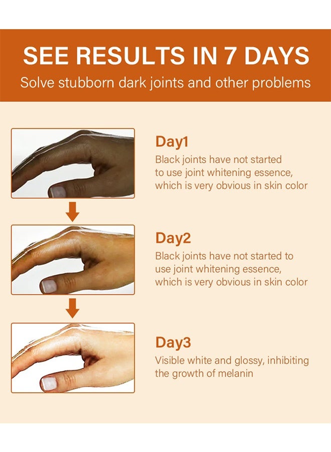 MOIKA Dark Knuckle Whitening Serum, Skin Body Bleaching For Dark Knees And Elbows, 7 Days Treatment For Dark Spots In Hand And Feet Knuckles Exfoliating Improves Dullness Powerful Whitening Effect For Men And Women, Moisturizing Strong Joint Whitening Serum, 30ML - Image 5