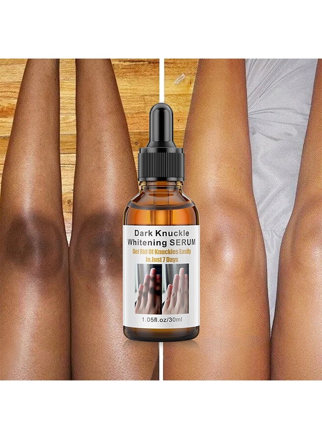 MOIKA Dark Knuckle Whitening Serum, Skin Body Bleaching For Dark Knees And Elbows, 7 Days Treatment For Dark Spots In Hand And Feet Knuckles Exfoliating Improves Dullness Powerful Whitening Effect For Men And Women, Moisturizing Strong Joint Whitening Serum, 30ML - Image 1