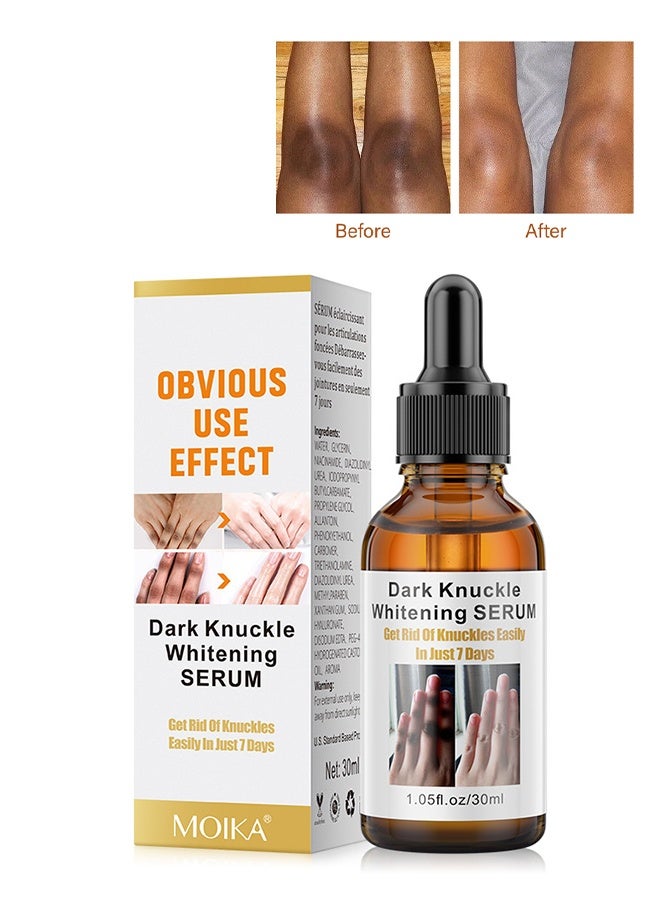 MOIKA Dark Knuckle Whitening Serum, Skin Body Bleaching For Dark Knees And Elbows, 7 Days Treatment For Dark Spots In Hand And Feet Knuckles Exfoliating Improves Dullness Powerful Whitening Effect For Men And Women, Moisturizing Strong Joint Whitening Serum, 30ML - Image 2