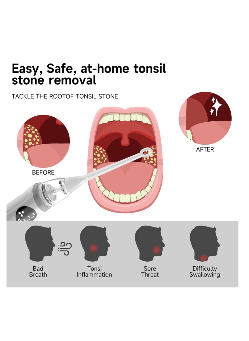 SYOSI Self-Help Tonsil Stone Removal Kit, Rechargeable Electric Vacuum Cleaner with 3-Speed Adjustable Suction, Reusable Oral Care Tool for Eliminating Oral Odor  - Image 3