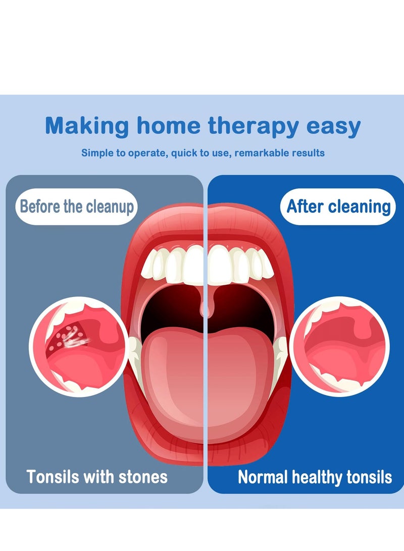 Self-Help Tonsil Stone Removal Kit, Rechargeable Electric Vacuum Cleaner with 3-Speed Adjustable Suction, Reusable Oral Care Tool for Eliminating Oral Odor