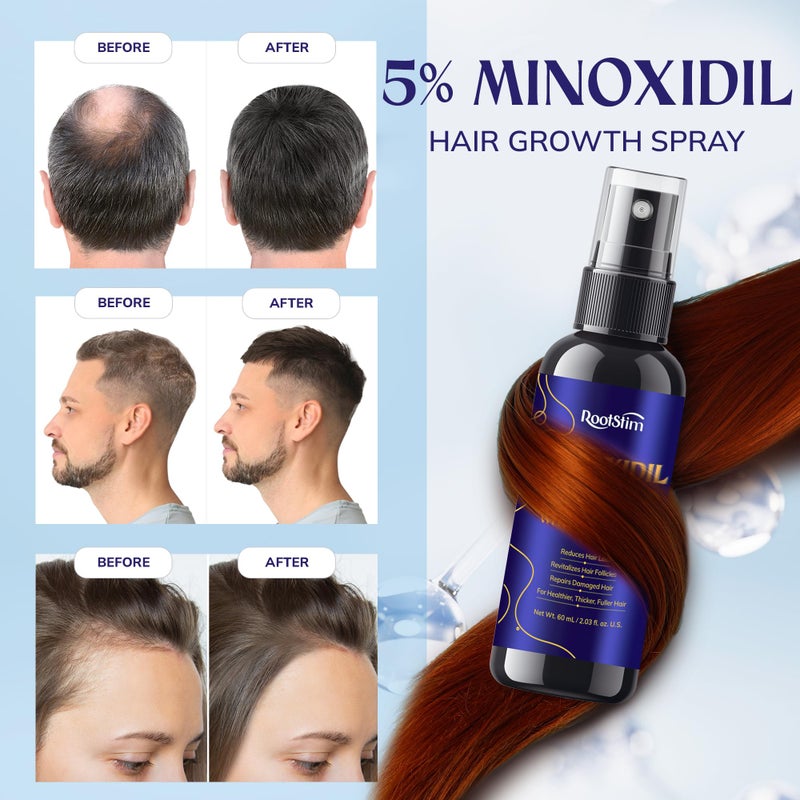 RootStim 5% Minoxidil Hair Growth for Men and Women: Extra Strength Minoxidil Hair Loss Treatment Serum with Rosemary for Faster Stronger Thicker Hair Growth 60ML - Image 4