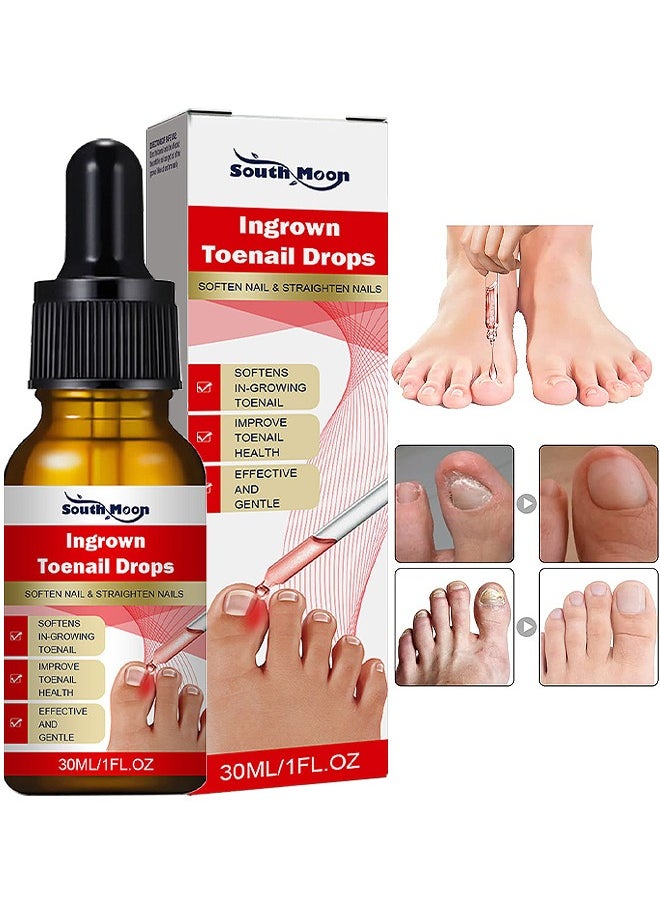 SOUTH MOON - Ingrown Toenail Drops Repair Essence, Nail Care Essential Oil Cleans And Removes Gray Nails, Toe Nail Repair Treatment Extra Strength For Thick Nails Cracked Damaged Discolored Yellow Nails - Image 1