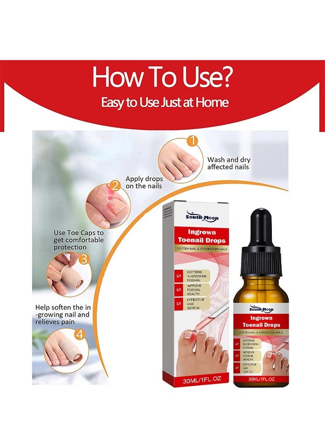 SOUTH MOON - Ingrown Toenail Drops Repair Essence, Nail Care Essential Oil Cleans And Removes Gray Nails, Toe Nail Repair Treatment Extra Strength For Thick Nails Cracked Damaged Discolored Yellow Nails - Image 1