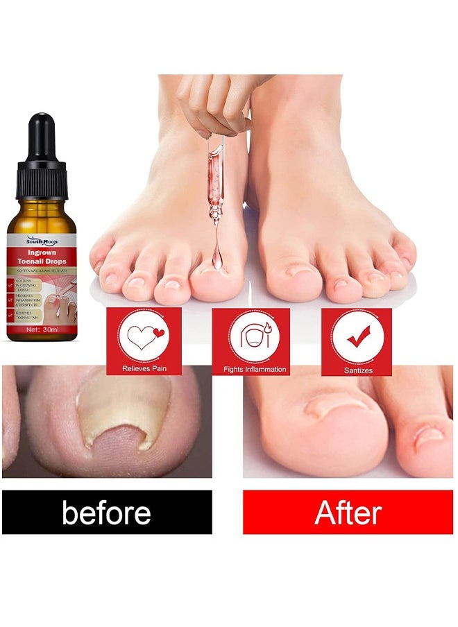 SOUTH MOON - Ingrown Toenail Drops Repair Essence, Nail Care Essential Oil Cleans And Removes Gray Nails, Toe Nail Repair Treatment Extra Strength For Thick Nails Cracked Damaged Discolored Yellow Nails - Image 1