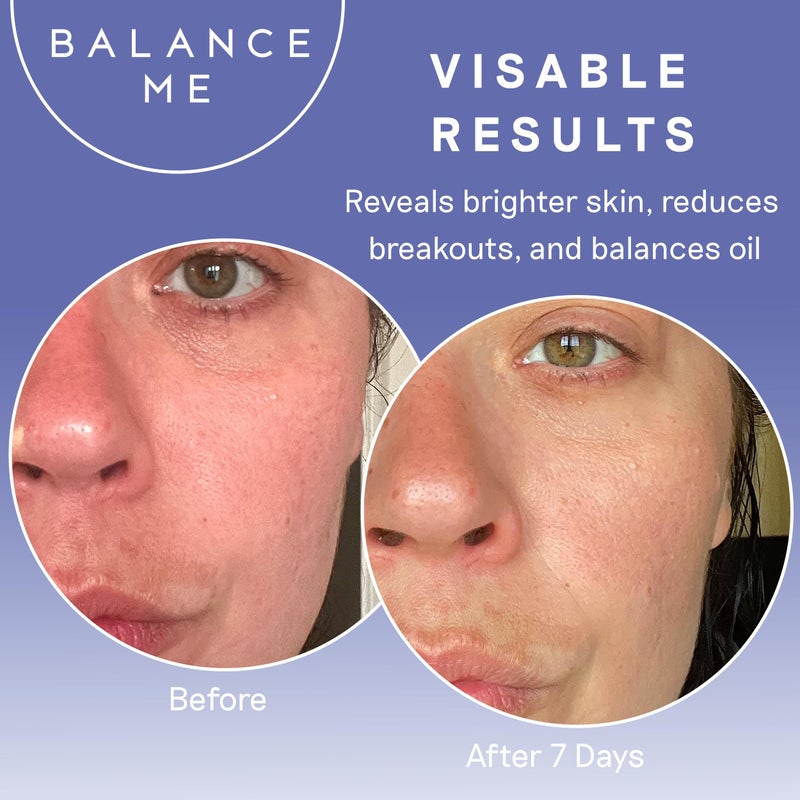 Balance Me Pure Skin Face Wash, Gentle Foaming Facial Cleanser with Moringa & Rice Bran (1 x 4.23 fl oz), Non Toxic Water-Based Facewash for Oily, Blemish-Prone & Sensitive Skin - Image 5