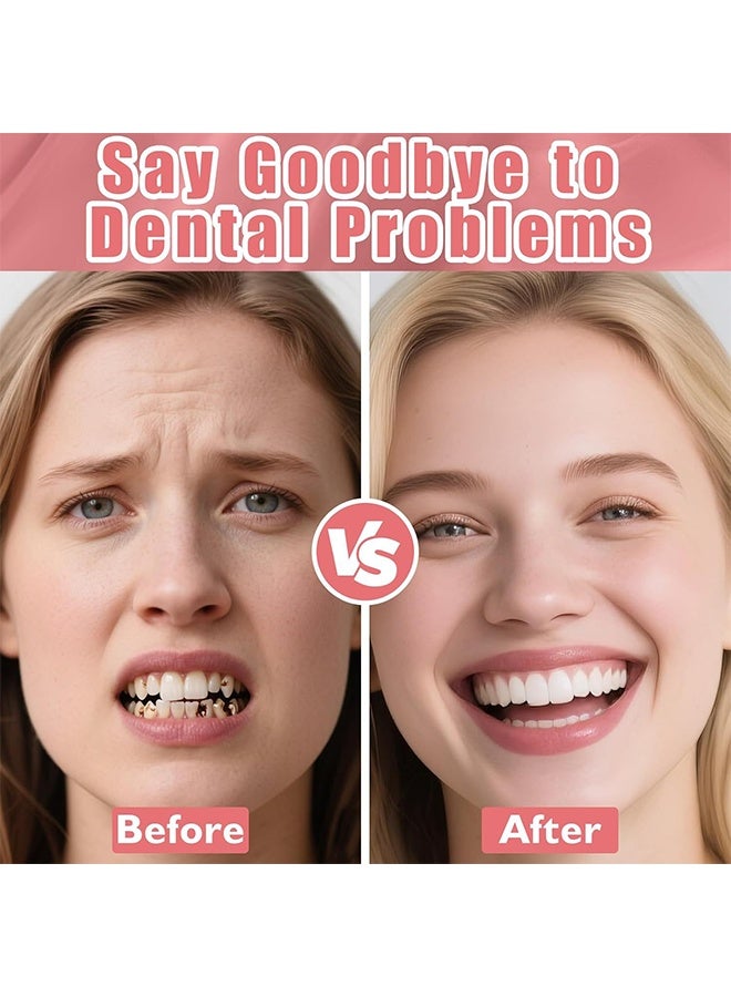 HOMTOPY Silicone Reline Denture Set, Comfortable Temporary Dental Restoration Kit, Soft Denture Reline Kit for Men and Women, Unisex Denture Reline Kit is Suitable for Securing Upper and Lower Dentures - Image 4