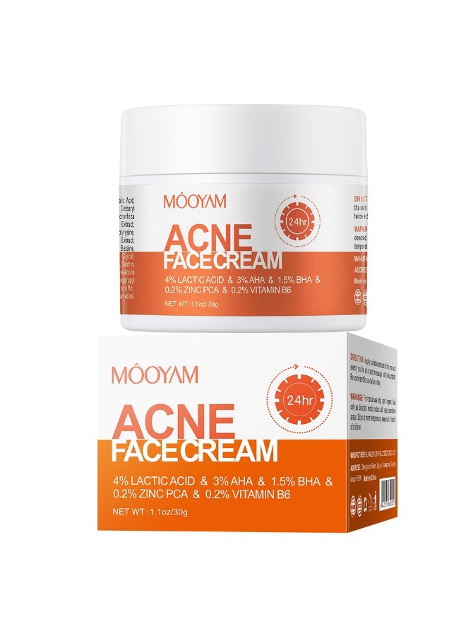 MOOYAM Acne Treatment for Face for Hormonal Cystic Stubborn Acne Cream for Sensitive Skin Teens Adults 30g - Image 5