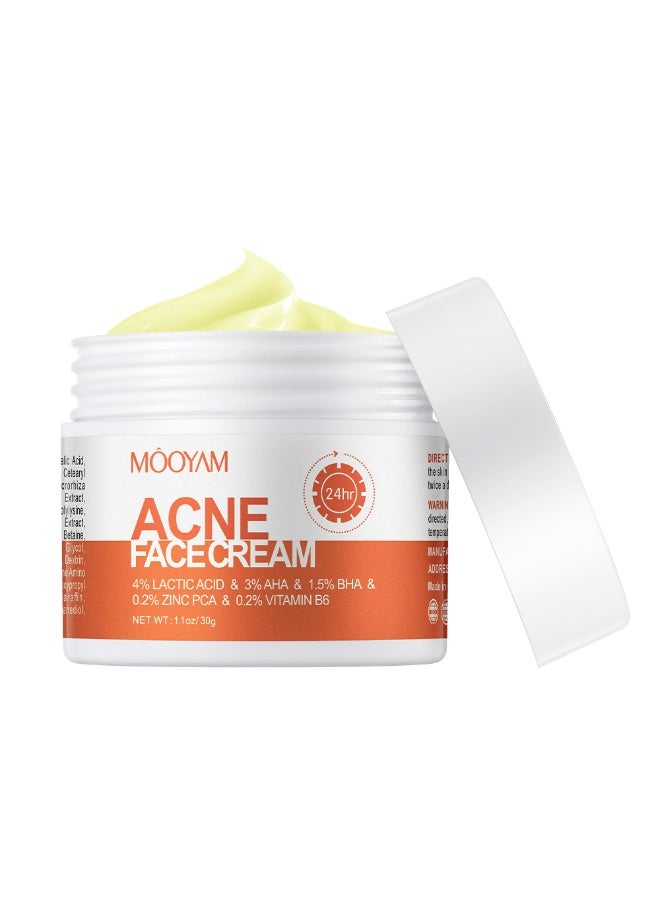 MOOYAM Acne Treatment for Face for Hormonal Cystic Stubborn Acne Cream for Sensitive Skin Teens Adults 30g - Image 4