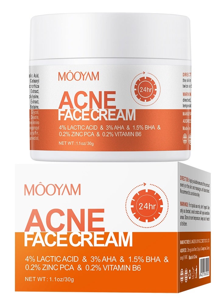 MOOYAM Acne Treatment for Face for Hormonal Cystic Stubborn Acne Cream for Sensitive Skin Teens Adults 30g - Image 2