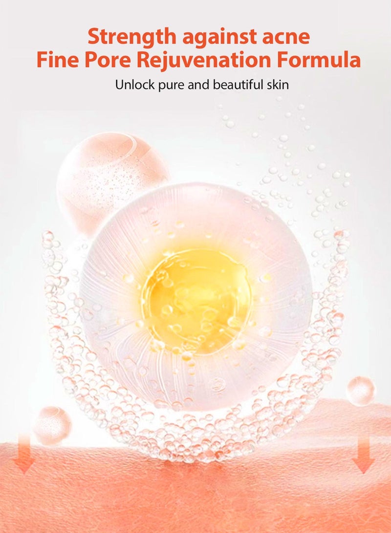 MOOYAM Acne Treatment for Face for Hormonal Cystic Stubborn Acne Cream for Sensitive Skin Teens Adults 30g - Image 5
