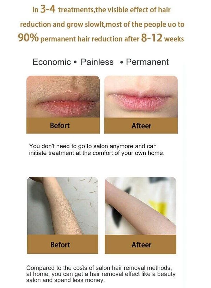 Contex IPL Hair Removal Laser Epilator For Women Painless Depilador - Image 5